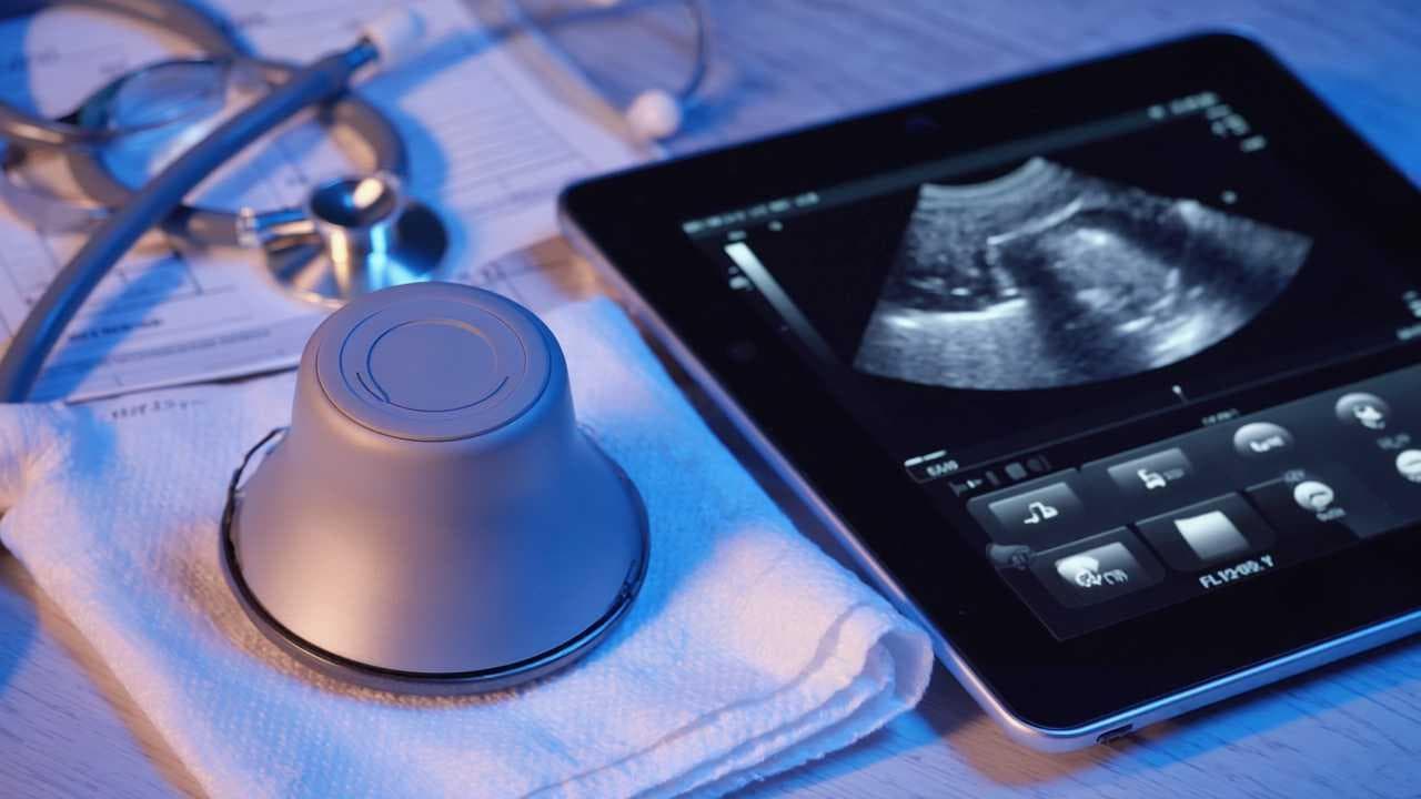 Medical professional reviewing ultrasound imaging results
